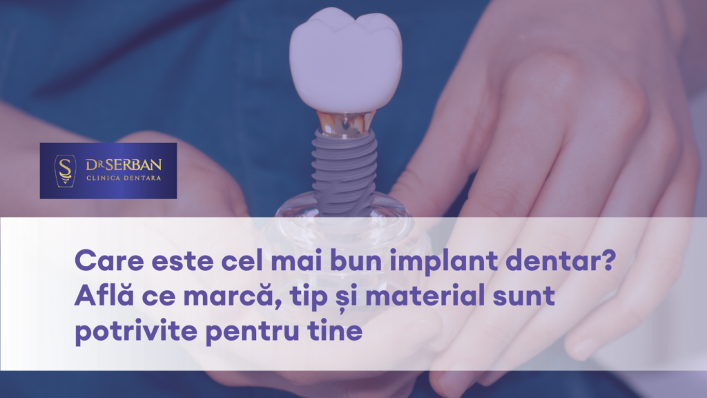 Care este cel mai bun implant dentar