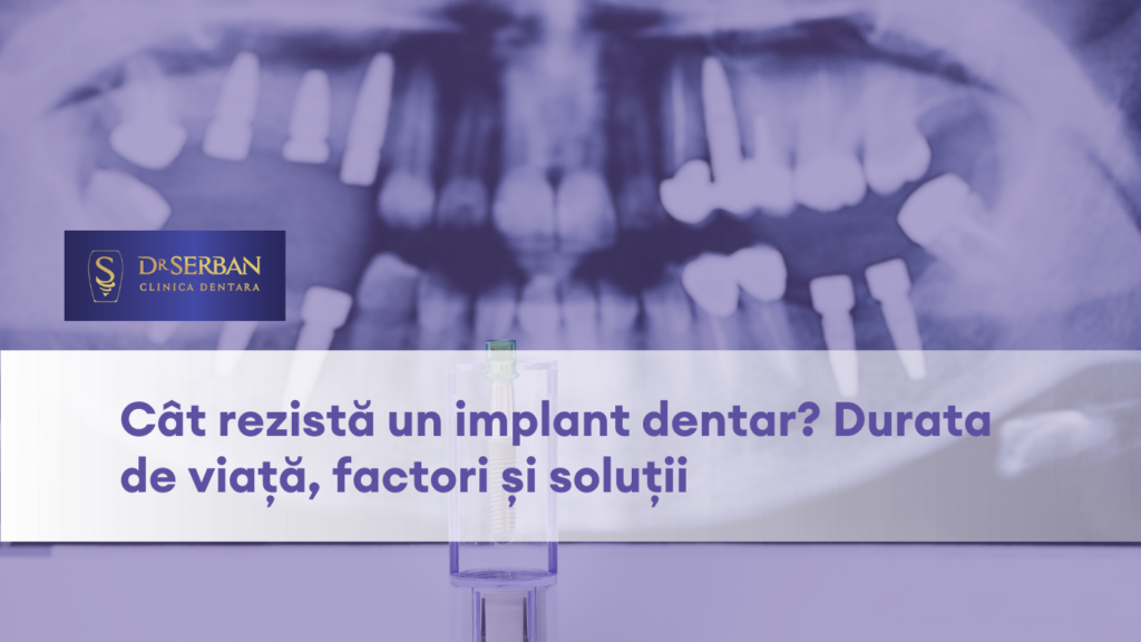 care este durata de viata a unui implant dentar