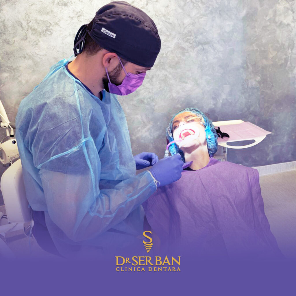 structura implant dentar