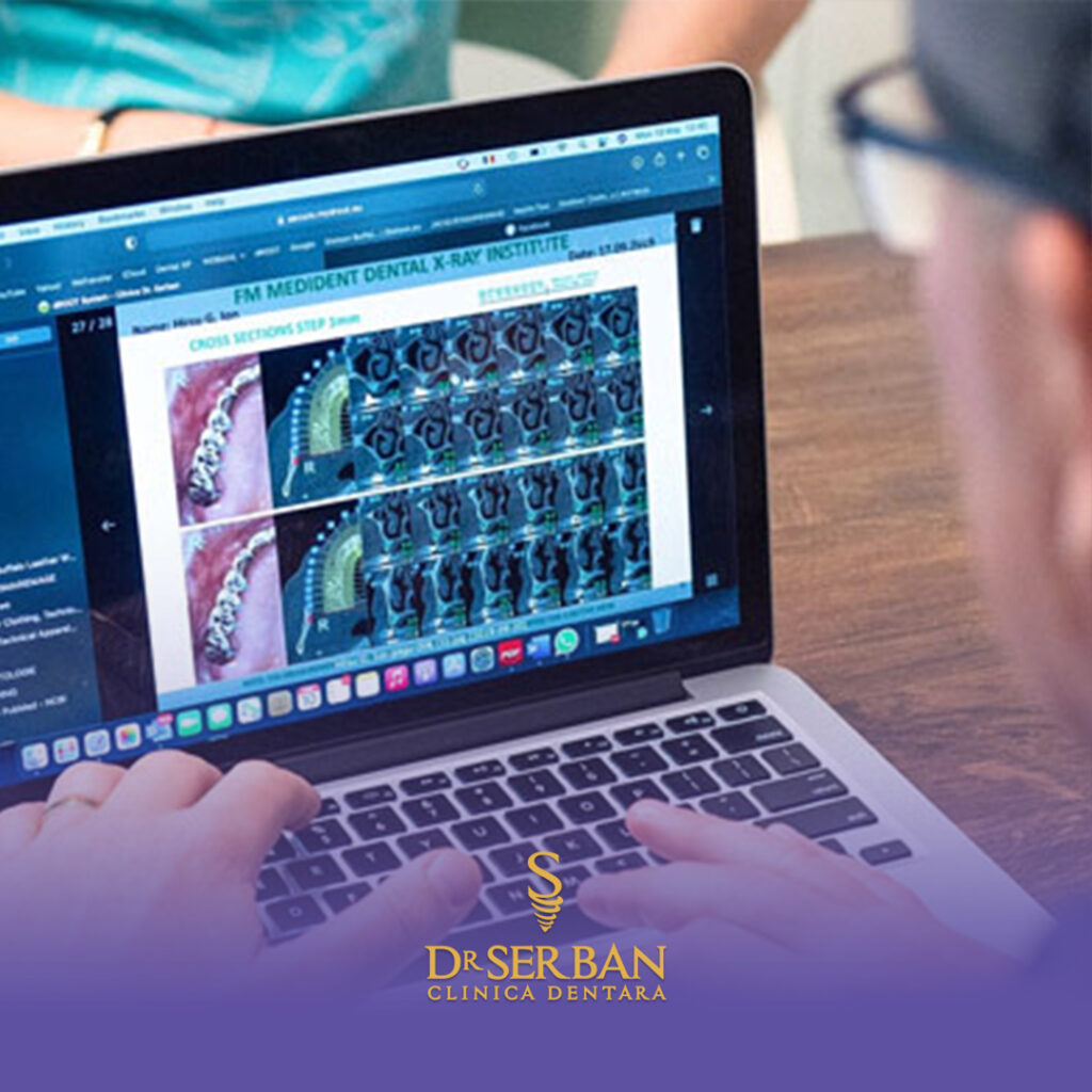 ce durata de viata are un implant dentar