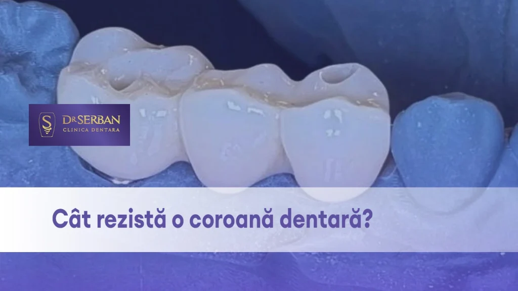 coroana-dentara-drserban