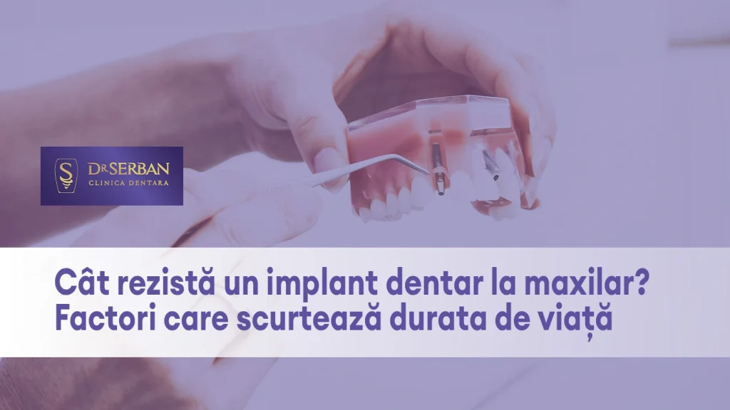 implant-dentar-la-maxilar-drserban