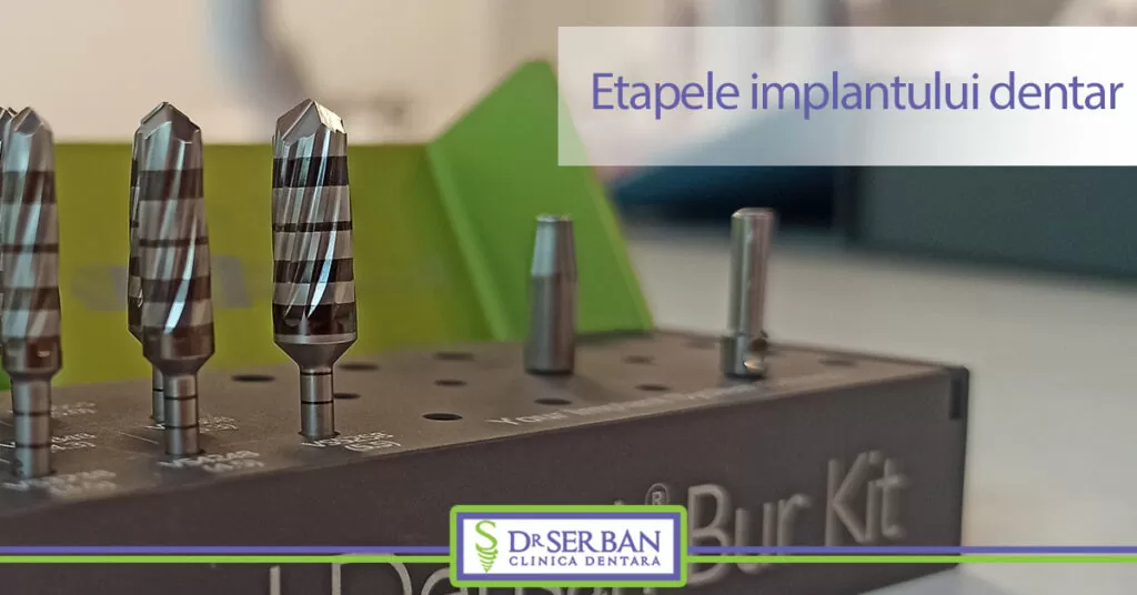 Etapele implantului dentar