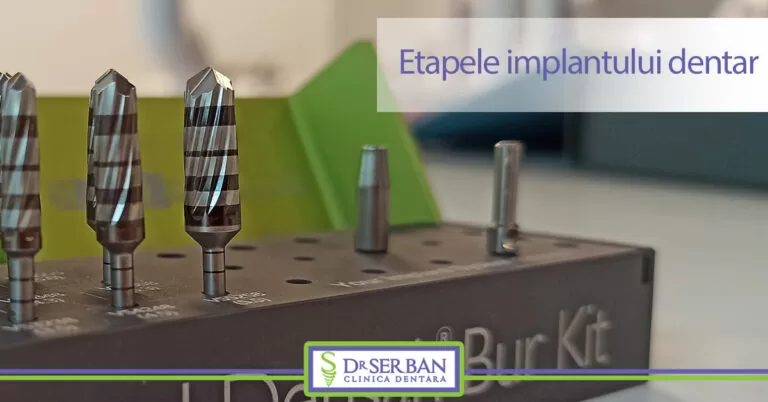 Etapele implantului dentar