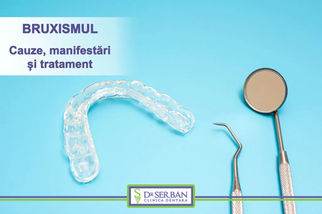 Bruxismul - Ce este? De ce apare? Cum se tratează?