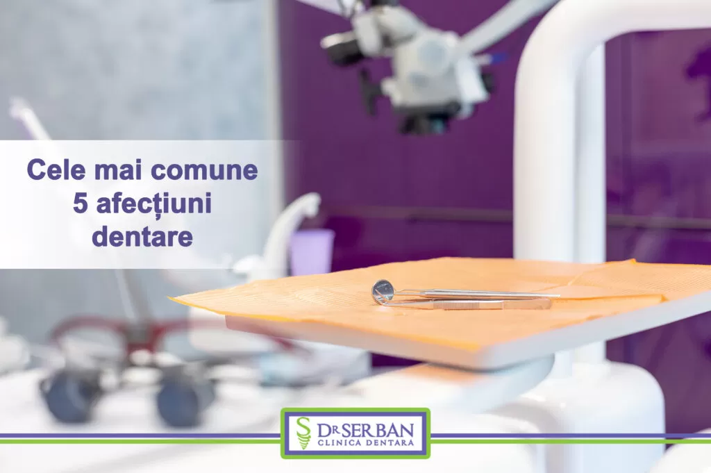 Cele mai comune 5 afecțiuni dentare