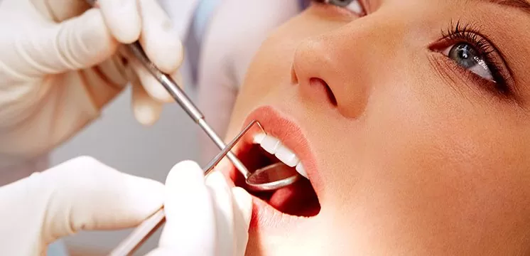 Despre detartraj si de ce este necesar