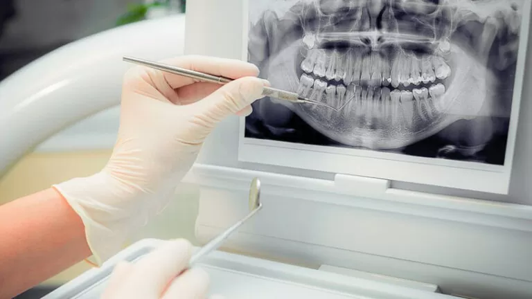 Radiografii Tratamente Dentare