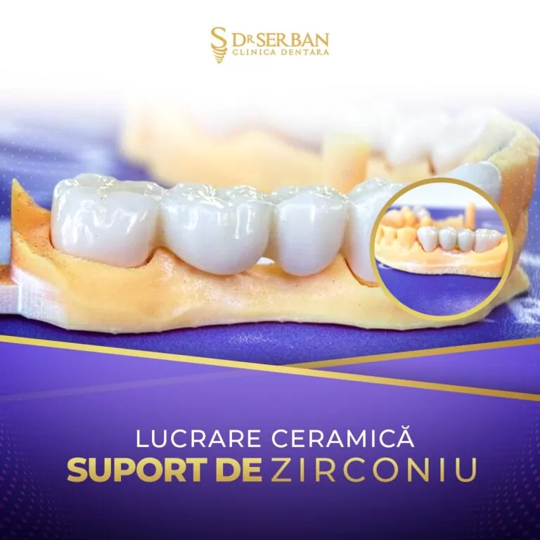 Coroane Dentare Bucuresti Sector 1