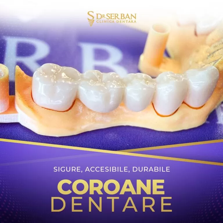 Coroane Dentare Bucuresti Sector 1