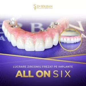 Fast and Fixed Dinti 24 Ore Bucuresti Sector 1