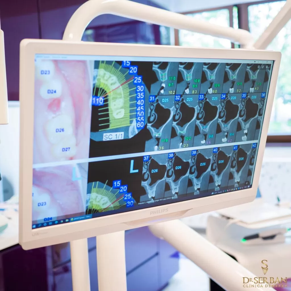 Consultatie Clinica Stomatologica Bucuresti Sector 1