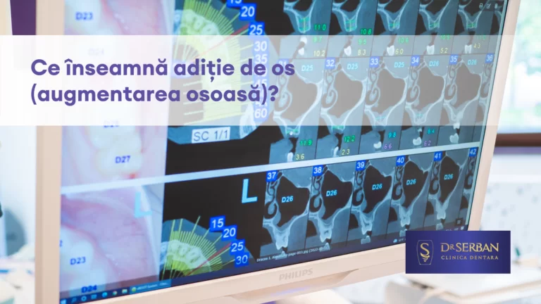 Ce inseamna aditie de os