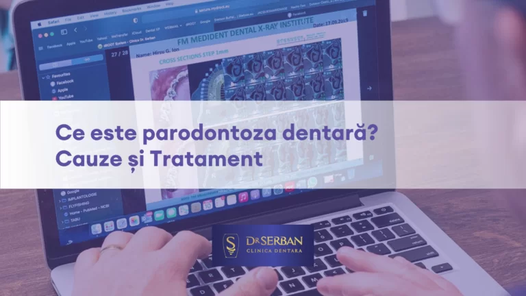 Ce este parodontoza dentară Cauze și Tratament.