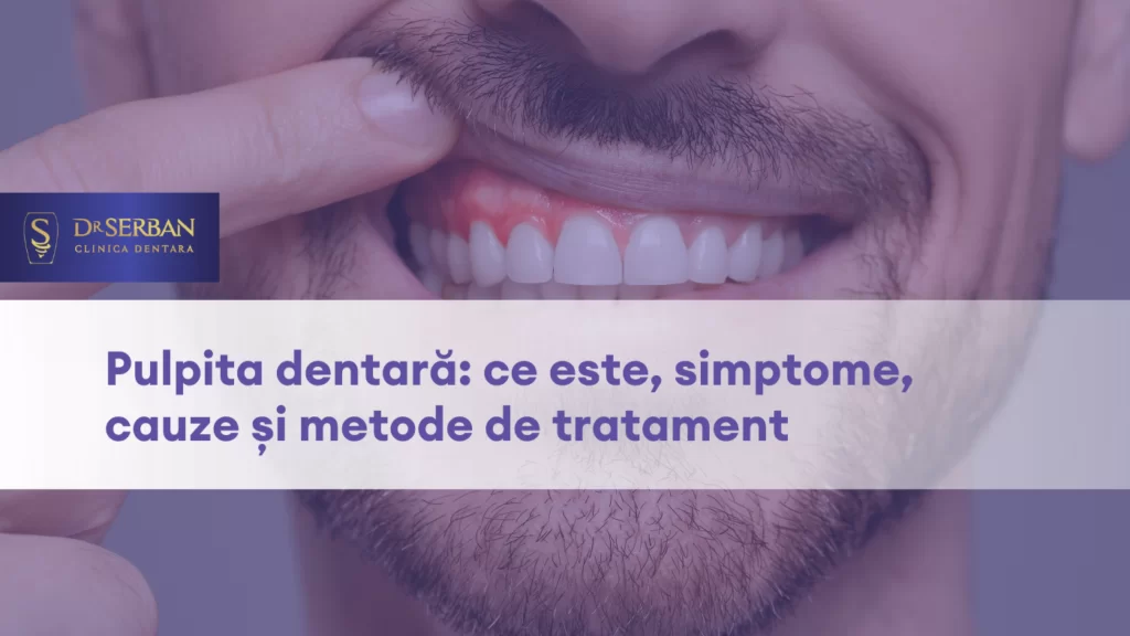 Pulpita dentară ce este, simptome, cauze și metode de tratament(1)