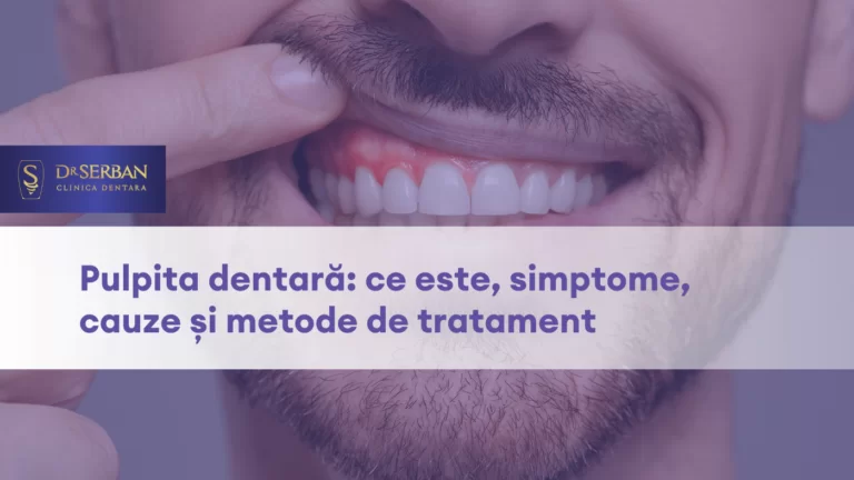 Pulpita dentară ce este, simptome, cauze și metode de tratament(1)