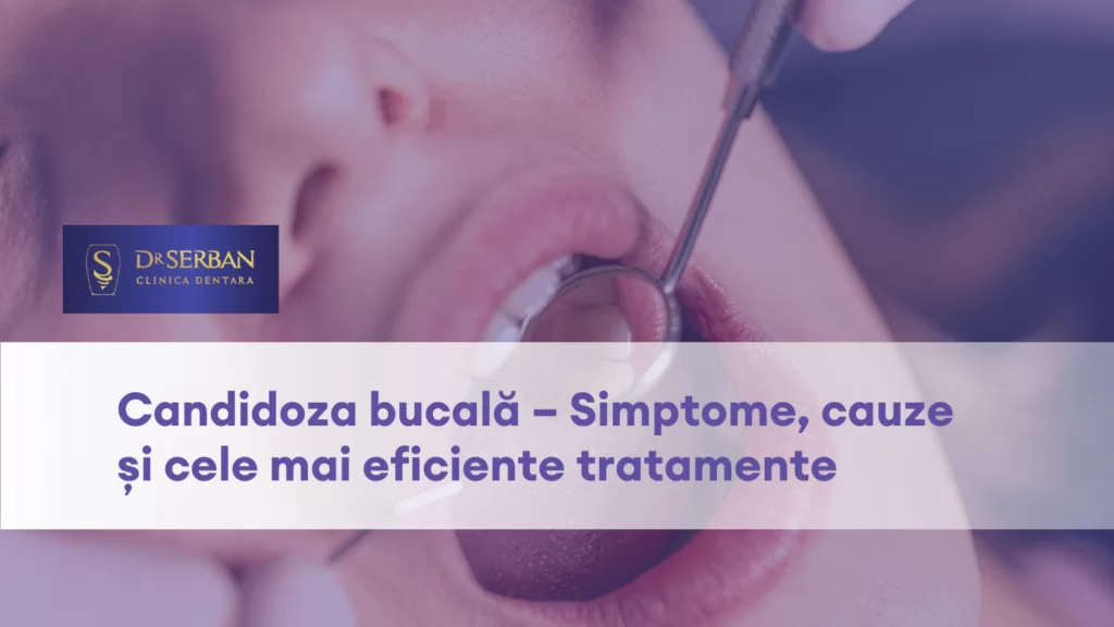 Candidoza bucala Simptome, Cauze si Tratamente