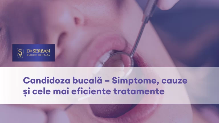 Candidoza bucala Simptome, Cauze si Tratamente