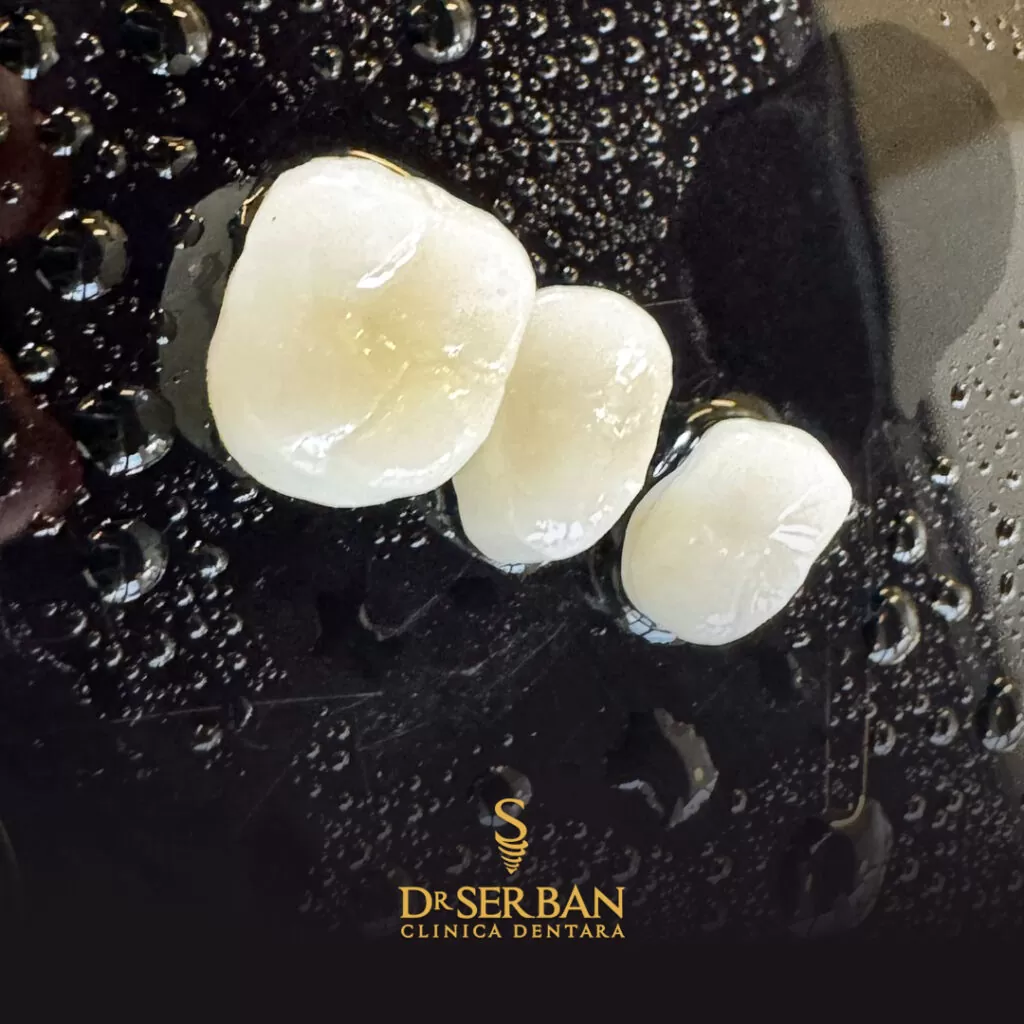 De ce e importantă o alimentație corectă după un implant dentar