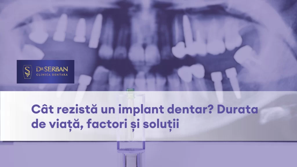 care este durata de viata a unui implant dentar