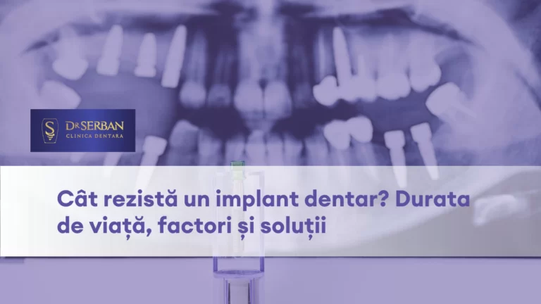 care este durata de viata a unui implant dentar